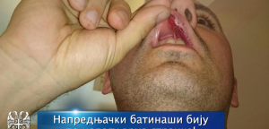 Naprednjački batinaši biju po nalogu vrha stranke!