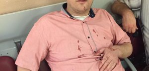 Brutalan napad u Sremskim Karlovcima!